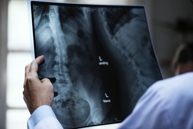 Conditions Treated by Sonospine Surgery